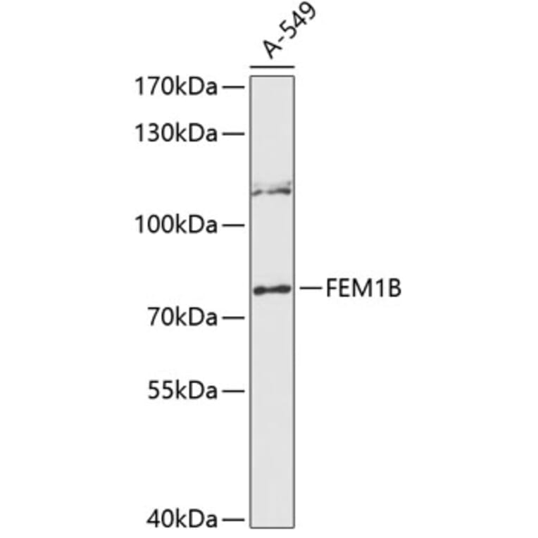 Western Blot - Anti-FEM1B Antibody (A91146) - Antibodies.com