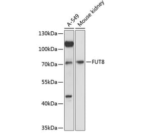 Western Blot - Anti-FUT8 Antibody (A91147) - Antibodies.com