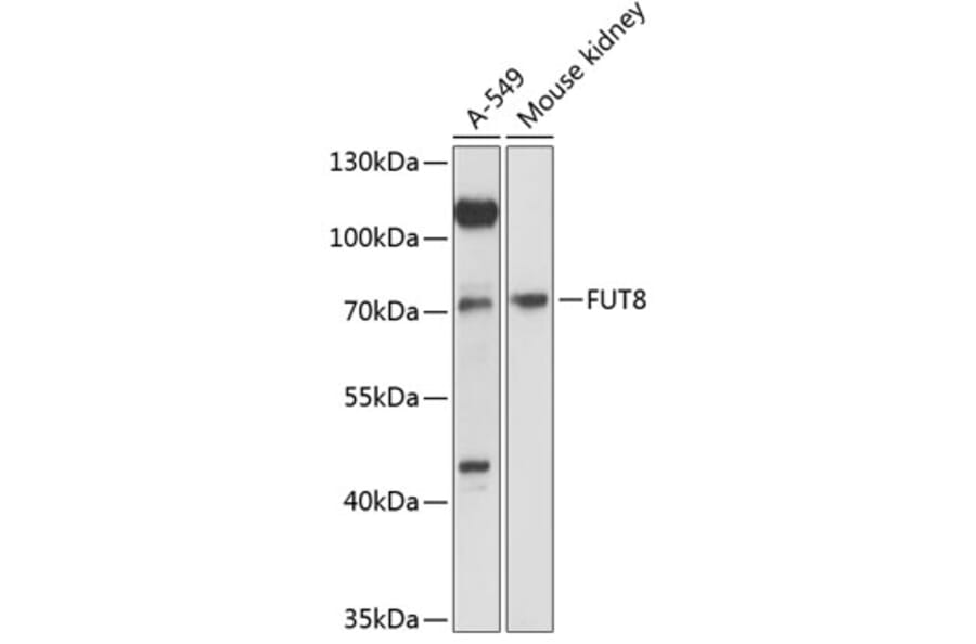 Western Blot - Anti-FUT8 Antibody (A91147) - Antibodies.com