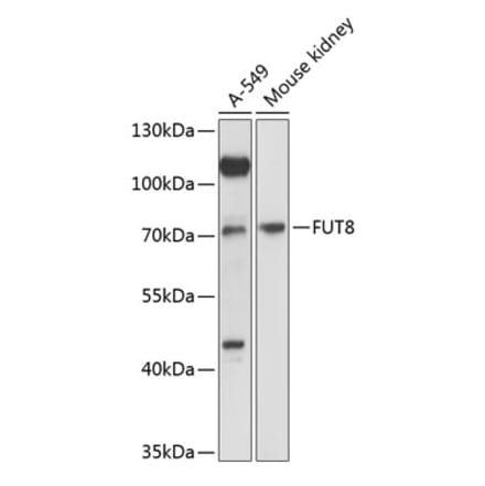 Western Blot - Anti-FUT8 Antibody (A91147) - Antibodies.com