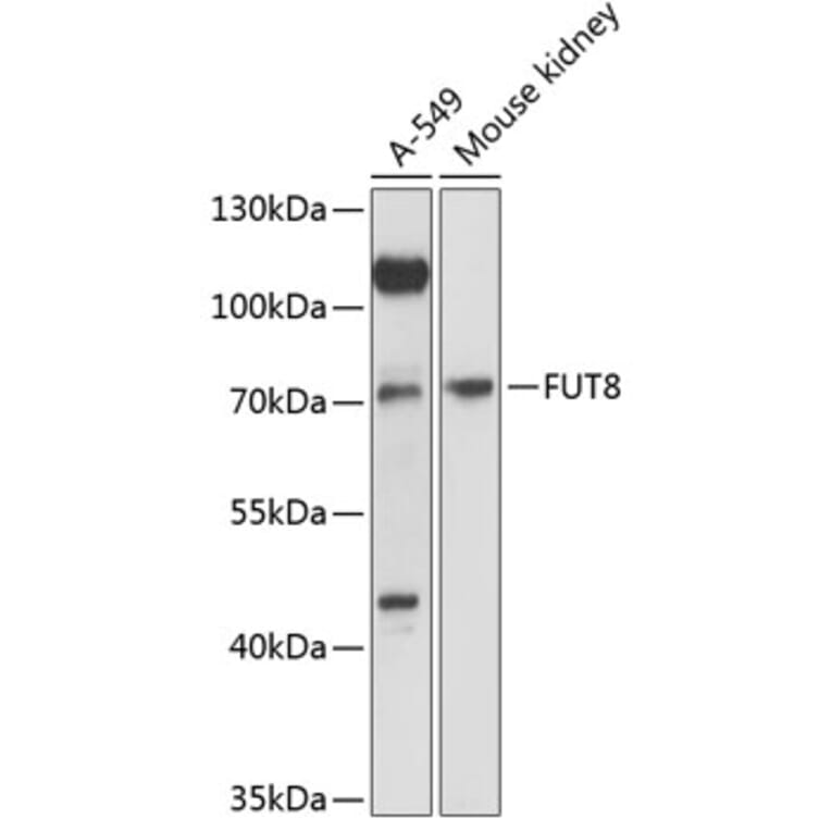Western Blot - Anti-FUT8 Antibody (A91147) - Antibodies.com