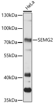 Western blot analysis of extracts of various cell lines, using Anti-SEMG2 Antibody (A12826) at 1:3000 dilution.
Secondary antibody: Goat Anti-Rabbit IgG (H+L) (HRP) (AS014) at 1:10,000 dilution.
Lysates / proteins: 25µg per lane.
Blocking buffer: 3% non-fat dry milk in TBST.
Detection: ECL Basic Kit (RM00020).
Exposure time: 30s.