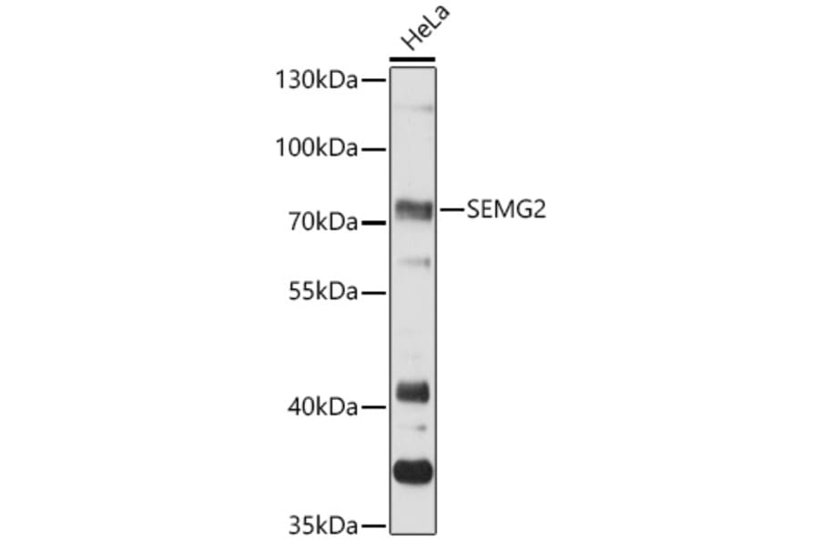 Western Blot - Anti-Semenogelin II/SGII Antibody (A91148) - Antibodies.com