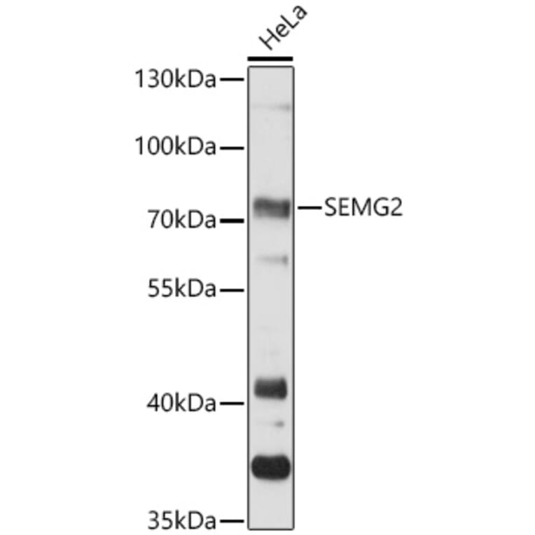 Western Blot - Anti-Semenogelin II/SGII Antibody (A91148) - Antibodies.com
