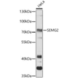 Western Blot - Anti-Semenogelin II/SGII Antibody (A91148) - Antibodies.com