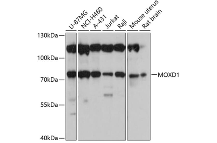 Western Blot - Anti-MOXD1/MOX Antibody (A91149) - Antibodies.com
