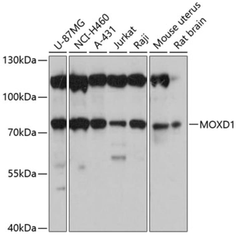 Western Blot - Anti-MOXD1/MOX Antibody (A91149) - Antibodies.com