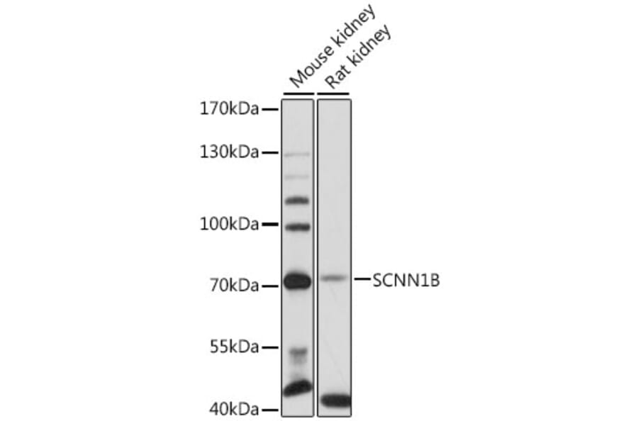 Western Blot - Anti-SCNN1B Antibody (A12699) - Antibodies.com