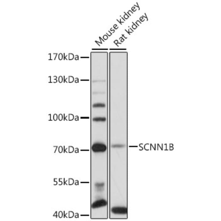 Western Blot - Anti-SCNN1B Antibody (A12699) - Antibodies.com