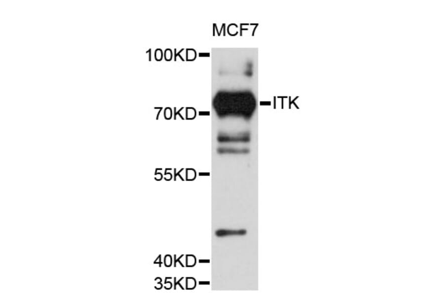 Western Blot - Anti-ITK Antibody (A12682) - Antibodies.com