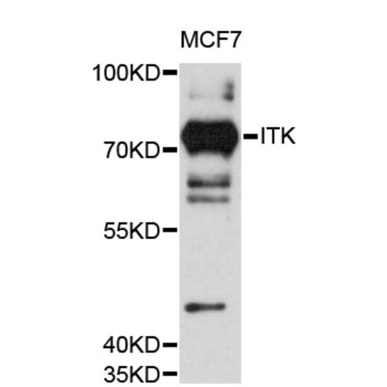 Western Blot - Anti-ITK Antibody (A12682) - Antibodies.com