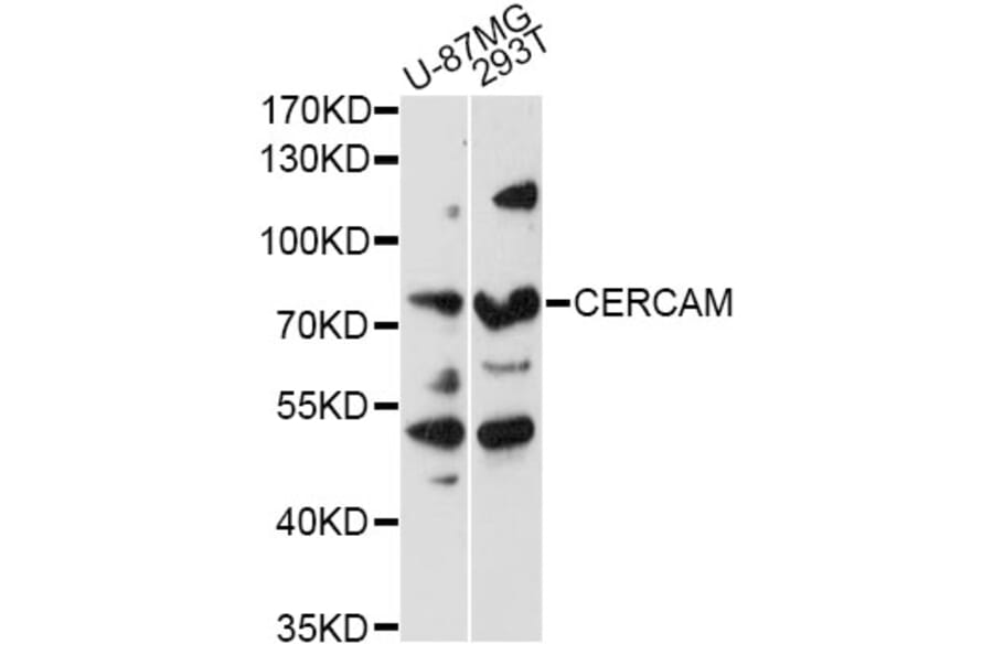 Western Blot - Anti-CERCAM Antibody (A14359) - Antibodies.com