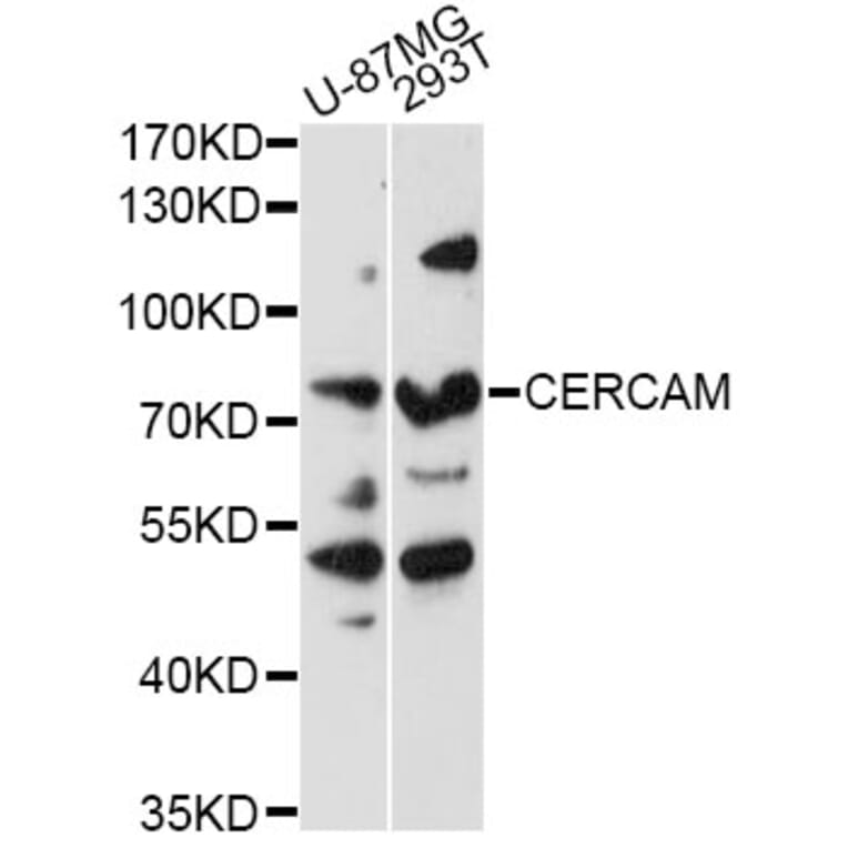 Western Blot - Anti-CERCAM Antibody (A14359) - Antibodies.com