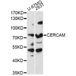 Western Blot - Anti-CERCAM Antibody (A14359) - Antibodies.com