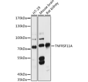 Western Blot - Anti-RANK Antibody (A91153) - Antibodies.com