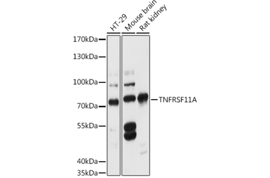 Western Blot - Anti-RANK Antibody (A91153) - Antibodies.com