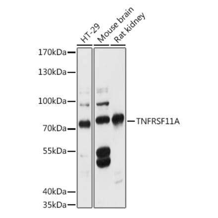 Western Blot - Anti-RANK Antibody (A91153) - Antibodies.com