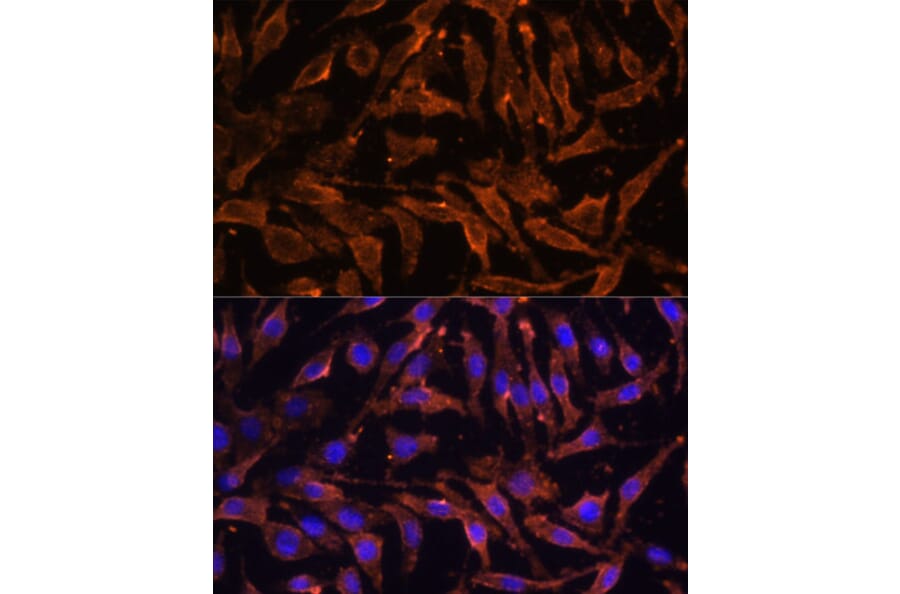Immunofluorescence - Anti-RANK Antibody (A91153) - Antibodies.com