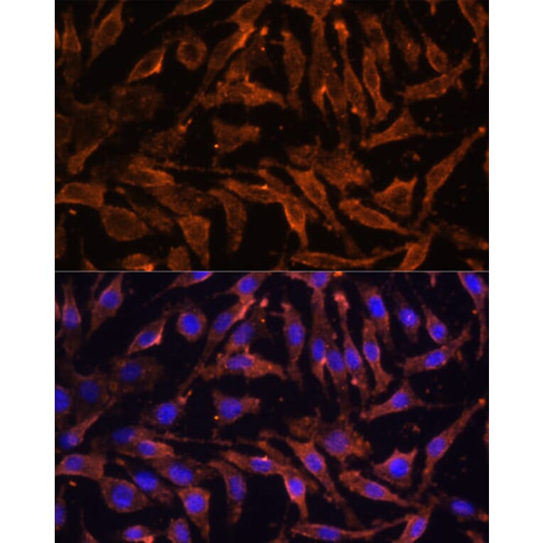 Immunofluorescence - Anti-RANK Antibody (A91153) - Antibodies.com