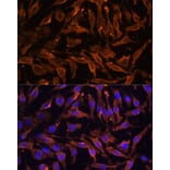 Immunofluorescence - Anti-RANK Antibody (A91153) - Antibodies.com