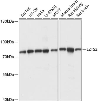 Western blot analysis of extracts of various cell lines, using Anti-LZTS2 Antibody (A14598) at 1:1,000 dilution.
Secondary antibody: Goat Anti-Rabbit IgG (H+L) (HRP) (AS014) at 1:10,000 dilution.
Lysates / proteins: 25µg per lane.
Blocking buffer: 3% non-fat dry milk in TBST.
Detection: ECL Basic Kit (RM00020).
Exposure time: 5s.