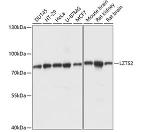 Western Blot - Anti-LZTS2 Antibody (A91154) - Antibodies.com