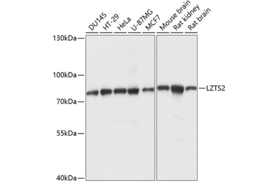 Western Blot - Anti-LZTS2 Antibody (A91154) - Antibodies.com