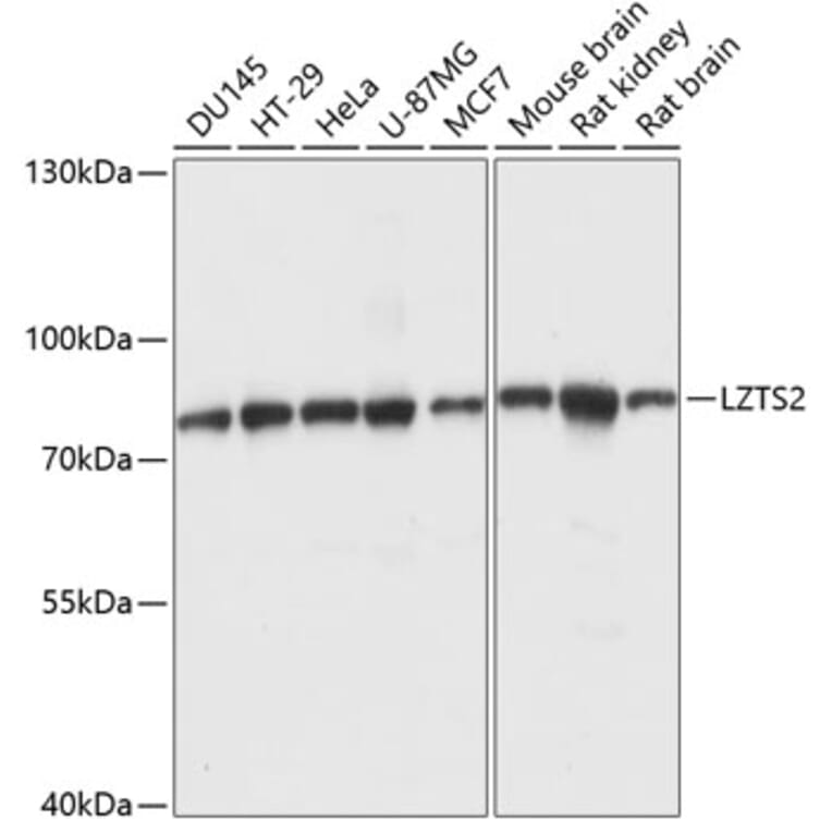 Western Blot - Anti-LZTS2 Antibody (A91154) - Antibodies.com