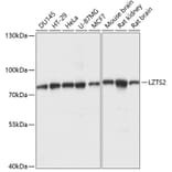 Western Blot - Anti-LZTS2 Antibody (A91154) - Antibodies.com