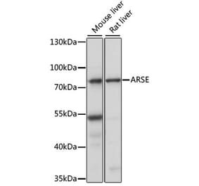 Western Blot - Anti-ARSL Antibody (A91156) - Antibodies.com