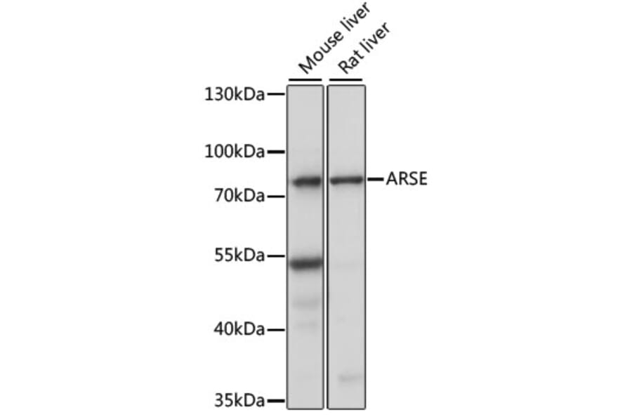 Western Blot - Anti-ARSL Antibody (A91156) - Antibodies.com