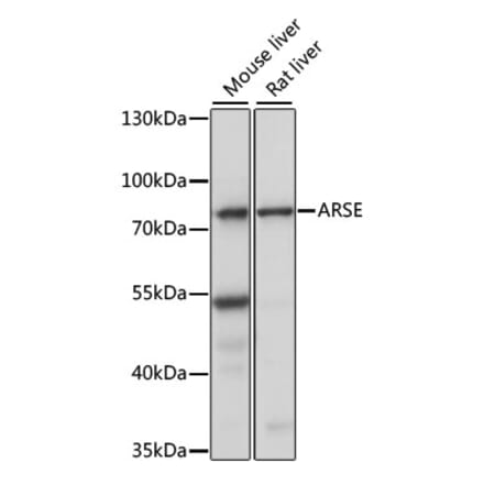 Western Blot - Anti-ARSL Antibody (A91156) - Antibodies.com