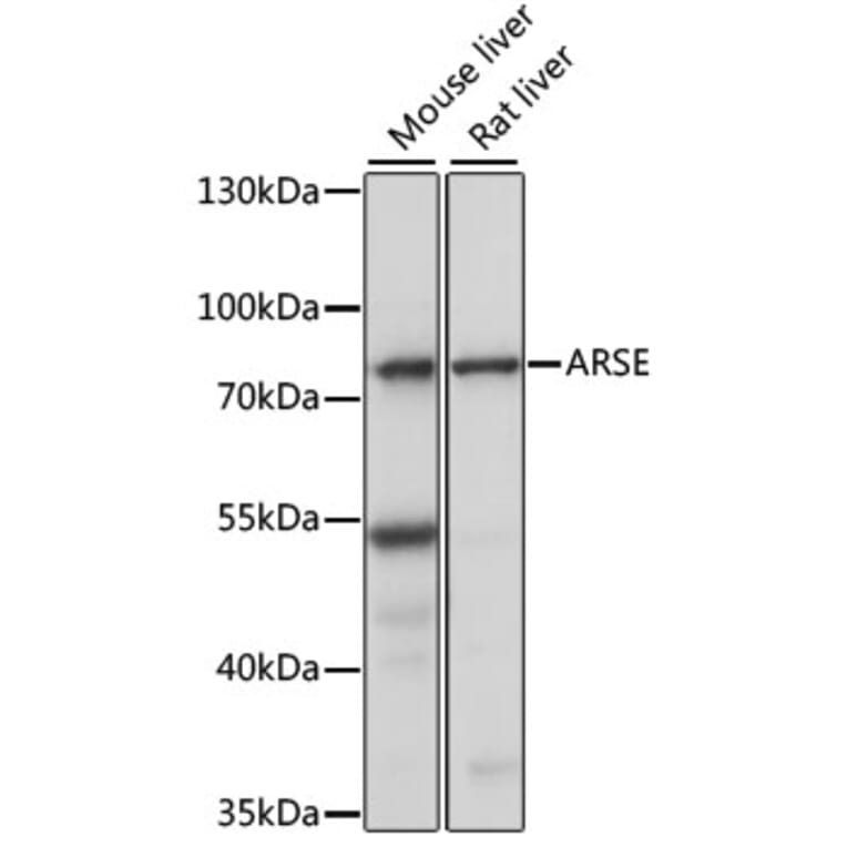 Western Blot - Anti-ARSL Antibody (A91156) - Antibodies.com