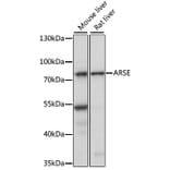 Western Blot - Anti-ARSL Antibody (A91156) - Antibodies.com