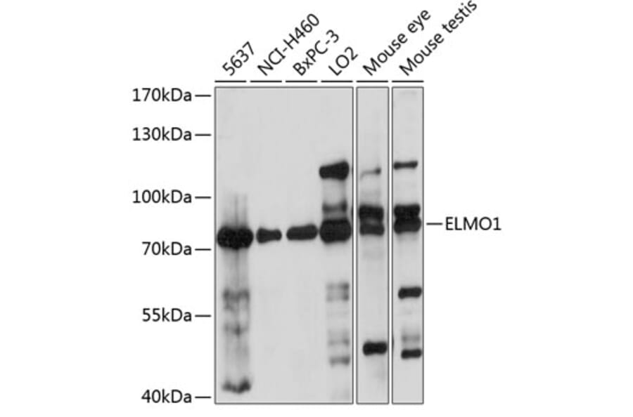 Western Blot - Anti-ELMO1 Antibody (A91157) - Antibodies.com