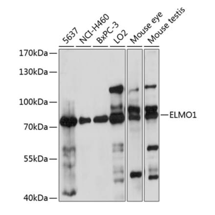 Western Blot - Anti-ELMO1 Antibody (A91157) - Antibodies.com