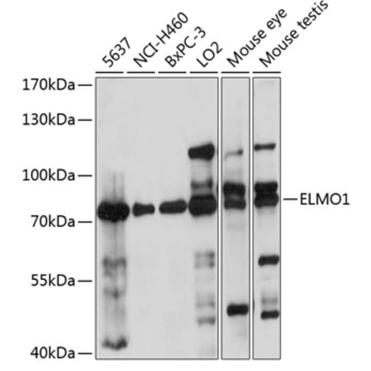 Western Blot - Anti-ELMO1 Antibody (A91157) - Antibodies.com