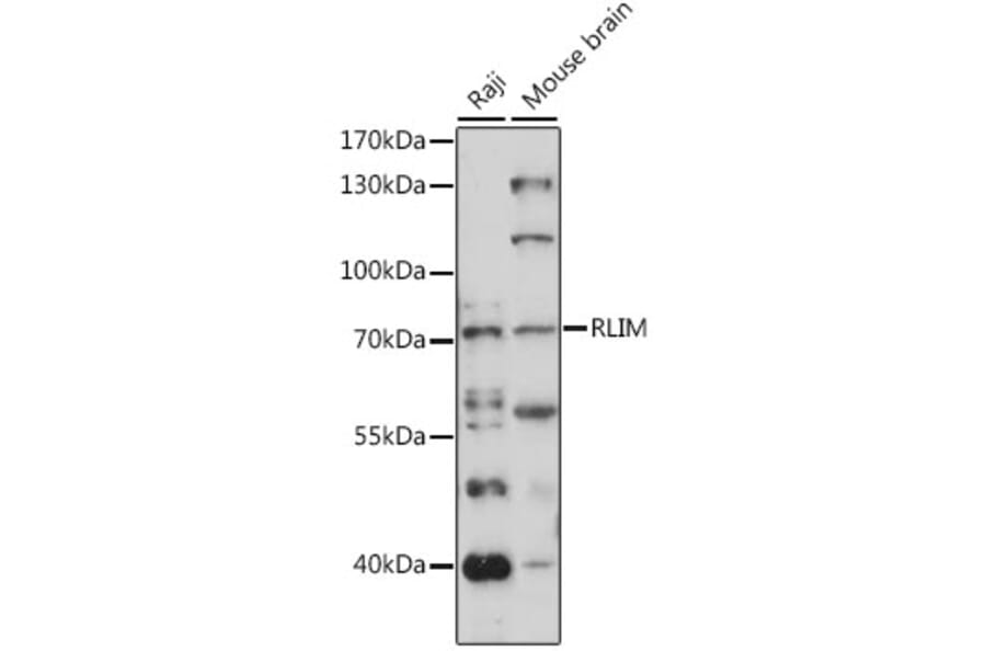 Western Blot - Anti-RLIM Antibody (A91158) - Antibodies.com