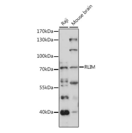 Western Blot - Anti-RLIM Antibody (A91158) - Antibodies.com