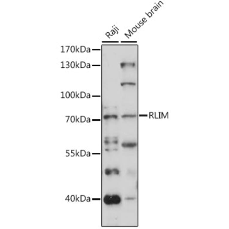 Western Blot - Anti-RLIM Antibody (A91158) - Antibodies.com