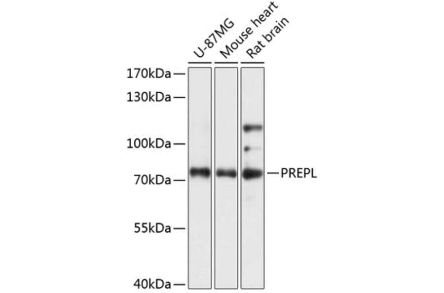 Western Blot - Anti-PPCEL/PREPL Antibody (A91159) - Antibodies.com