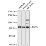 Western Blot - Anti-PPCEL/PREPL Antibody (A91159) - Antibodies.com