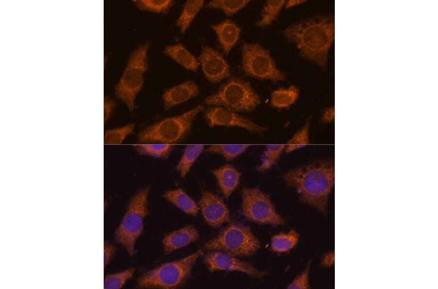 Immunofluorescence - Anti-PPCEL/PREPL Antibody (A91159) - Antibodies.com