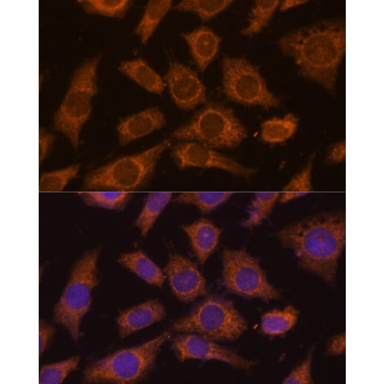 Immunofluorescence - Anti-PPCEL/PREPL Antibody (A91159) - Antibodies.com