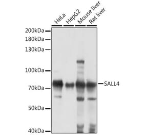 Western Blot - Anti-Sall4 Antibody (A91160) - Antibodies.com