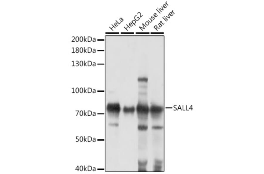 Western Blot - Anti-Sall4 Antibody (A91160) - Antibodies.com