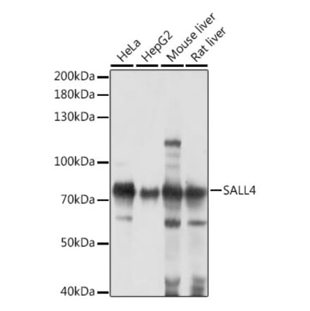 Western Blot - Anti-Sall4 Antibody (A91160) - Antibodies.com