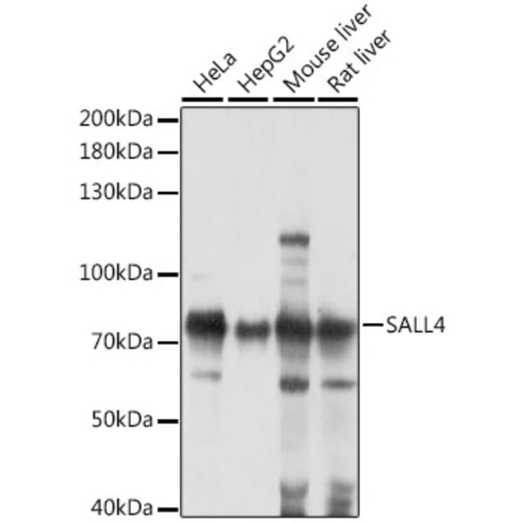 Western Blot - Anti-Sall4 Antibody (A91160) - Antibodies.com