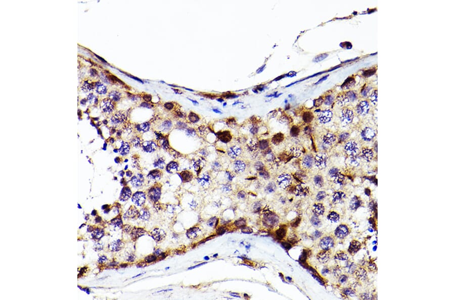 Immunohistochemistry - Anti-Sall4 Antibody (A91160) - Antibodies.com