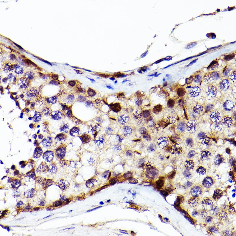 Immunohistochemistry - Anti-Sall4 Antibody (A91160) - Antibodies.com